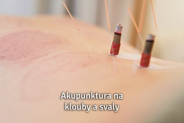 akupunktura na klouby a svaly
